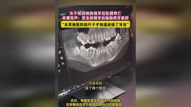 终于知道34岁女子为什么拔个牙会跳楼了，找到原因后瞬间理解了