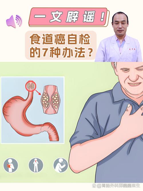 食管癌一查就是恶性？其实喉咙早早给了暗示！2个迹象，尽早筛查