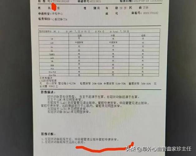 52岁武汉女子，血管狭窄70%成功降到35%医生：3个好习惯值得借鉴